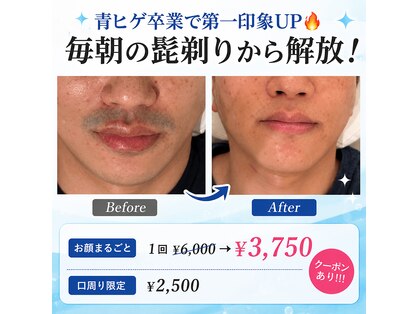 ルシアル(LUCIALL)の写真