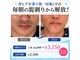 ルシアル(LUCIALL)の写真