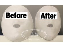 美極 トータルビューティー(美極 TOTAL BEAUTY)/恵比寿/小顔コルギ/エステ/