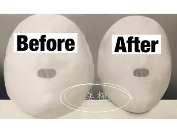 美極 トータルビューティー(美極 TOTAL BEAUTY)/恵比寿/小顔コルギ/エステ/