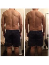 フェリーチェ ビューティー(Felice Beauty)/電磁パルス