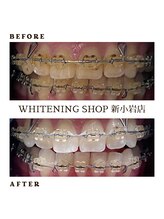 ホワイトニングショップ 新小岩店/サロンでケア◎ホワイトニング◎