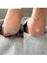 フットミー(foot mii)/