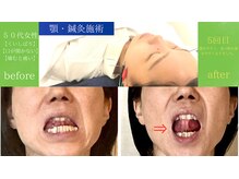 鍼灸院シマダ 宇多津(鍼灸院SHIMADA)/顎関節の鍼灸