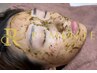 【毛穴/ニキビケア】剥離なしハーブピーリングでちゅるん卵肌