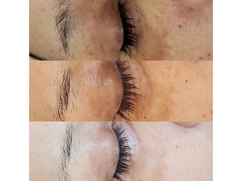 美肌工務店/しみ改善!