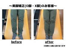 トータルビューティーみつとも/O脚矯正/美脚矯正