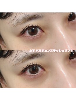 レディエント(Radiant)/上下パリジェンヌラッシュリフト