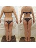 【部分筋膜リリース】コリ、疲れ、身体の歪みを改善、痩せやすい体に　￥9500