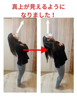 千葉駅前腰痛整体院/反りやすくて真上が見えます