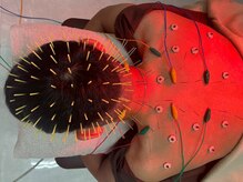 メディカルジャパン 国分寺の雰囲気（頭皮鍼で頭スッキリ♪睡眠＆首肩コリや頭皮ケアにも◎）