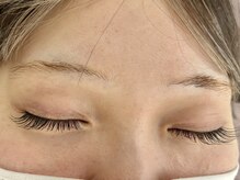 ピュア リ(Ri)/パッチリ