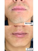 バディーズ(BUDDieS)/20代