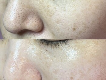 エミュ(emu)/ハーブで艶々