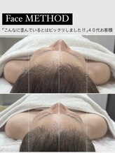 ソルヴィス(SOLVIS)/