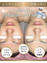 ソユ(SOYOU)/施術* &nbsp;&nbsp;&nbsp;&nbsp;&nbsp;&nbsp;&nbsp;ダクトピール