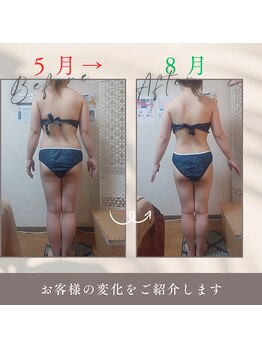 プライベートエステ カモミール/ハイパーマジック回数券にて