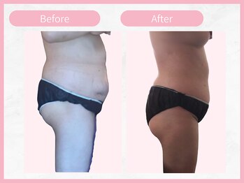 アールエイチビー 藤沢店(RHB)/