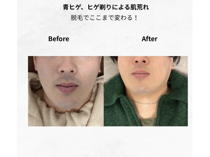 マリーローラン メンズルイズ(Marryrolan MensRuise)の写真