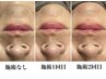 【時短ケア】毛穴洗浄＋全顔脱毛 ￥16000→￥6980