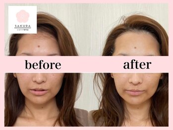サクラ(SAKURA)/いつまでも綺麗んで若々しく◎