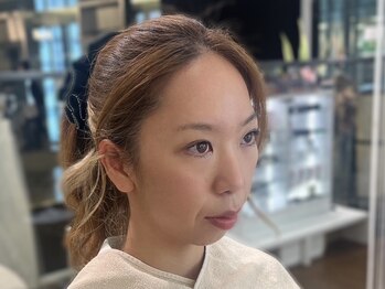 ビューティーガーデン イース/BEFORE