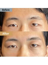 眉毛ハウス 吉祥寺店(眉毛HOUSE)/お客様の施術例(吉祥寺/東京)