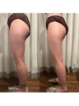 フフラ KANコルギセラピー山梨本店(fufla)/【ウルトランスフォーマー】