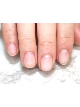 爪の悩みを解消できる（ケア含む）