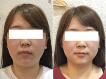 美容整体ウェリナ 名駅院/小顔矯正/骨盤矯正/美脚サロン