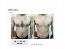 シズク ビューティーサロン(SHIZUKU beauty salon )/