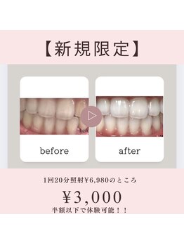 ホワイトニングショップ 山形店(Whiteningshop)/新規限定！！