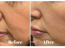 カラーリリー アンド ユン(Calla lily & yun)/ヒト幹細胞でお肌が元気に！