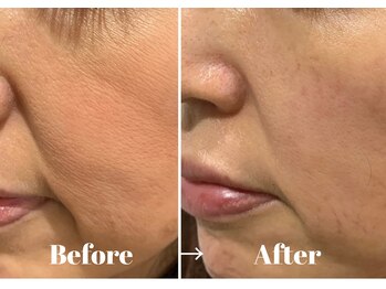 カラーリリー アンド ユン(Calla lily & yun)/ヒト幹細胞でお肌が元気に！