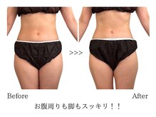 リュシータ 吹田千里丘店(LUSHEETA)/【 VENUS痩身 】(40代前半)