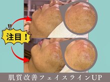 プレジール(plaisir)/一度で効果実感