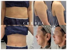 クレビア(CREBIA)