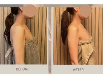 クララ(clara)の写真/身体の歪み,姿勢の改善に◎漢方アロマオイルで体質,悩みに合わせて深部からほぐしラインを美しく整える♪