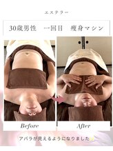 エステラー(ESTELLER)/30歳男性痩身マシン一回目