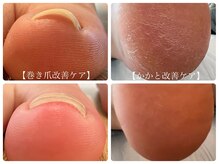 ルドネ ヴィ アシヤ(Redonner vie Ashiya)の雰囲気（巻き爪/踵のひび割れ/トラブル爪のお悩みを根本から改善します）