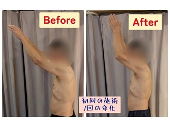スアビス(SUAVIS)の写真/【沖縄で希少】エレクトロ筋膜リリース導入！どこに行ってもダメだったガチガチの首や肩の辛さも徹底ケア◎