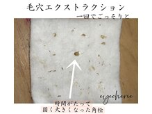アイシェリー(eyecherie)/毛穴エクストラクション