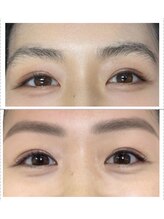 ビフォーアフター 小吹店(BeforeAfter)/◇Before After◇