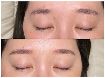 シアン(CYAN)/困り眉 解消