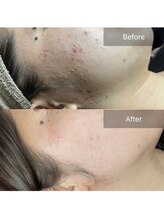 リノリー(rinory)/VOSサロンケア