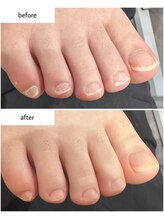 ケアプラス(care plus)/フットネイルケア