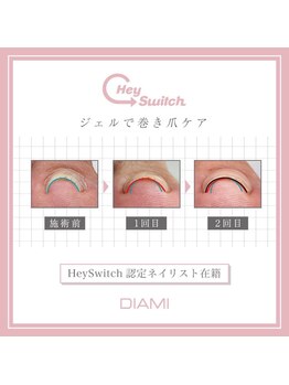 Hey Switch 巻き爪ケアジェル