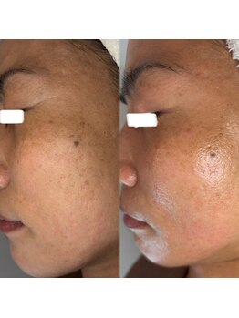 エミナル(EMINALu)/お肌の基礎を磁気で蘇らせる