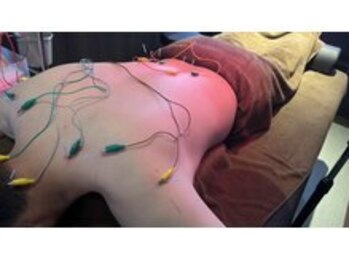 康泰苑鍼灸整体院/肩腰の深部へ鍼通電アプローチ