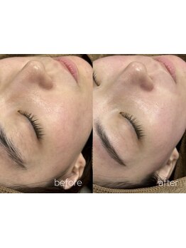 お肌をきれいにしたい